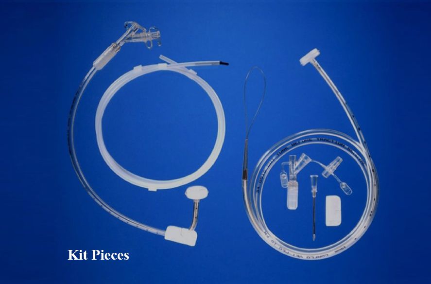 MILA PEGキット （内視鏡設置用）