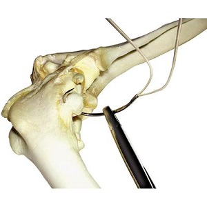 Cruciate Needle X-Small 15mm 4個セット